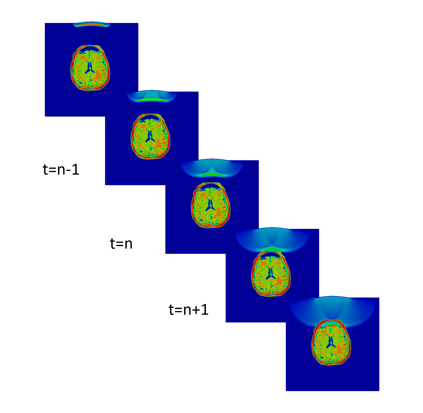 Sequence of focused-ultrasound fields propagating through a brain.