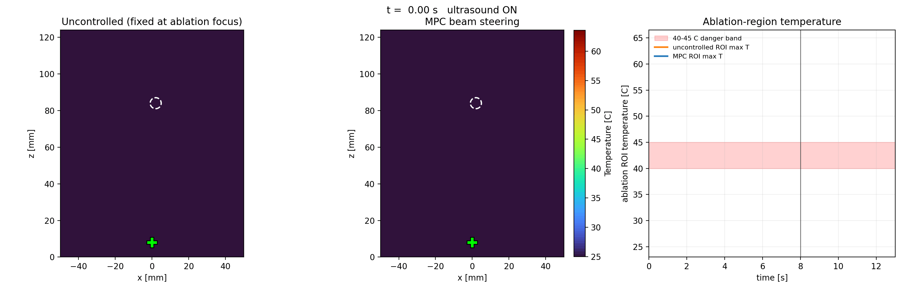 Side-by-side animation of uncontrolled versus MPC-steered focused-ultrasound heating with the ablation-region temperature trace.